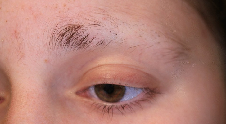 ما أسباب تساقط شعر الحاجبين فجأة؟