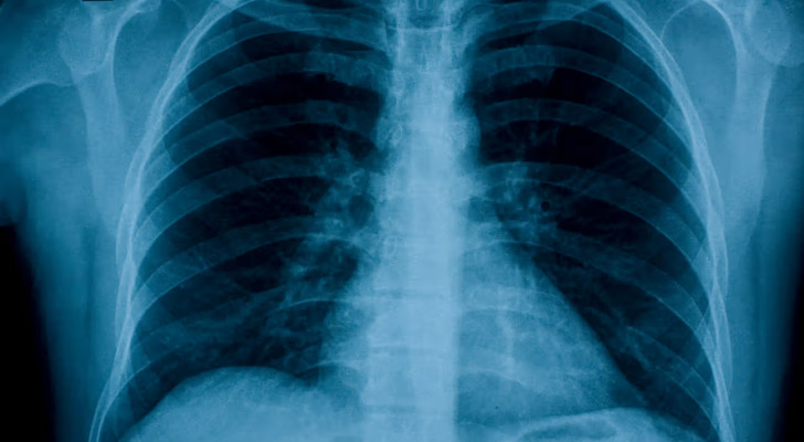 أعجوبة.. رجل يعيش 48 ساعة دون رئتين! والسبب؟