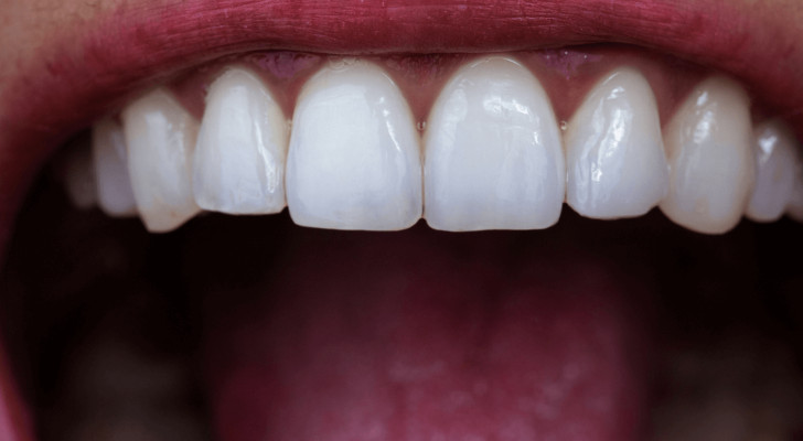 أطعمة ومشروبات تدمر مينا الأسنان بصمت.. نستهلكها يوميا دون أن ننتبه