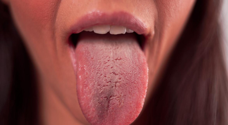 ماذا يحدث لجسمك عند نقص فيتامين B12؟ أعراض خطيرة لا تتجاهلها