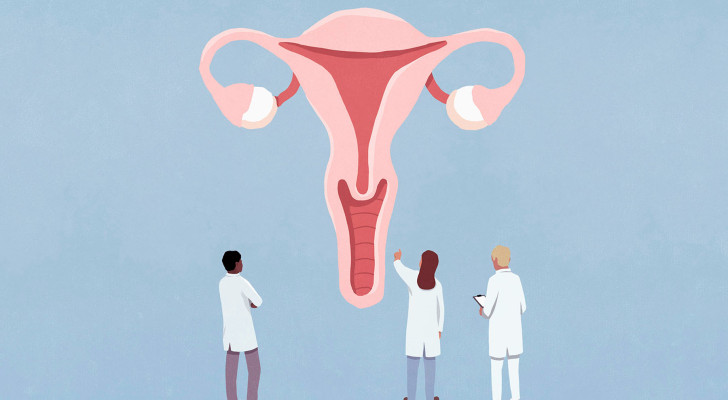 رسميا.. وداعا لـ PCOS.. العالم الطبي يغير اسم متلازمة تكيس المبايض! والسبب؟