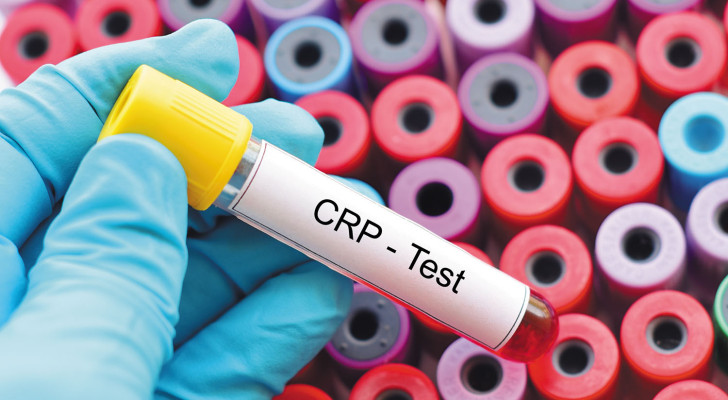 ارتفاع عامل الالتهاب CRP دون أعراض.. هل يشير إلى مرض خفي؟