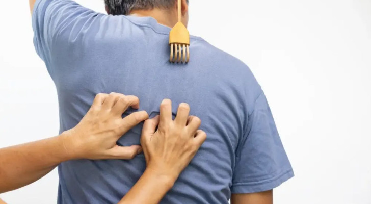 لماذا تزداد حكة الظهر في نهاية اليوم؟.. أسباب قد لا تتوقعها