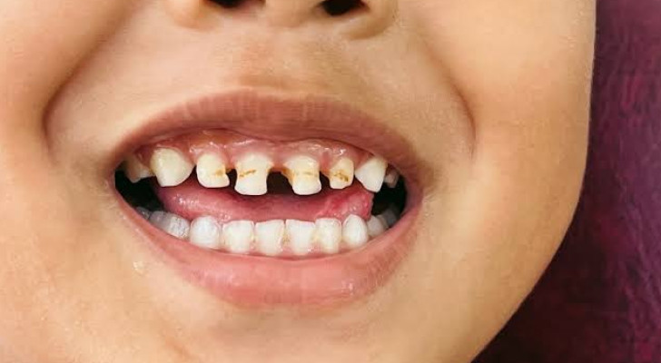أبحاث جديدة تكشف الخطر.. التدخين أمام طفلك قد يؤثر في أسنانه مستقبلا!