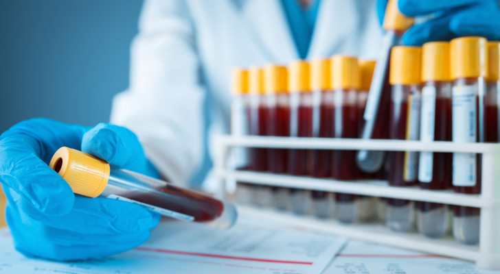 ما الفرق بين تحليل الحديد ومخزون الحديد Ferritin؟ ولماذا قد يختلفان؟