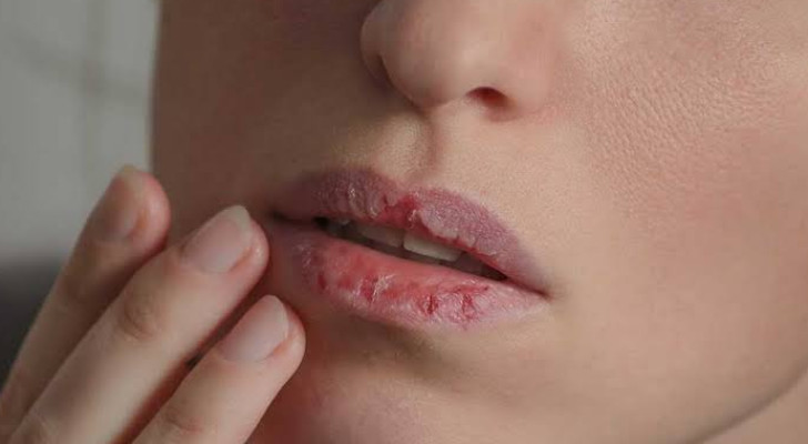 إذا كان فمك جافا كل صباح.. لا تفترض أن السبب هو قلة الماء! 7 أسباب قد تكون وراء ذلك