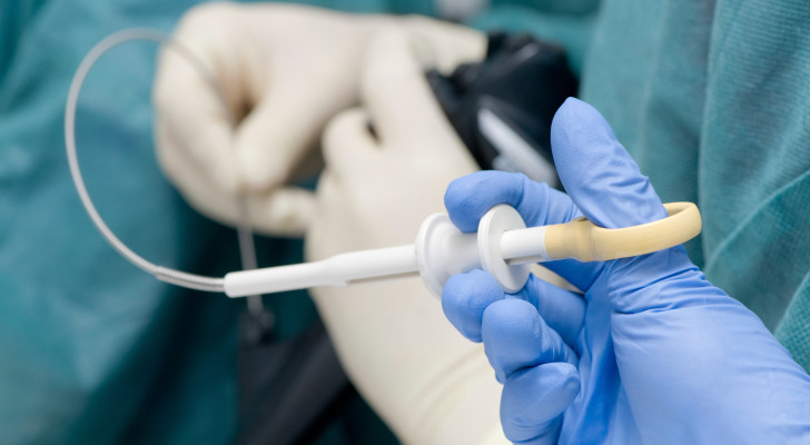 أعراض هضمية متكررة؟ علامات تخبرك أن الوقت حان لتنظير المعدة (التنظير العلوي)