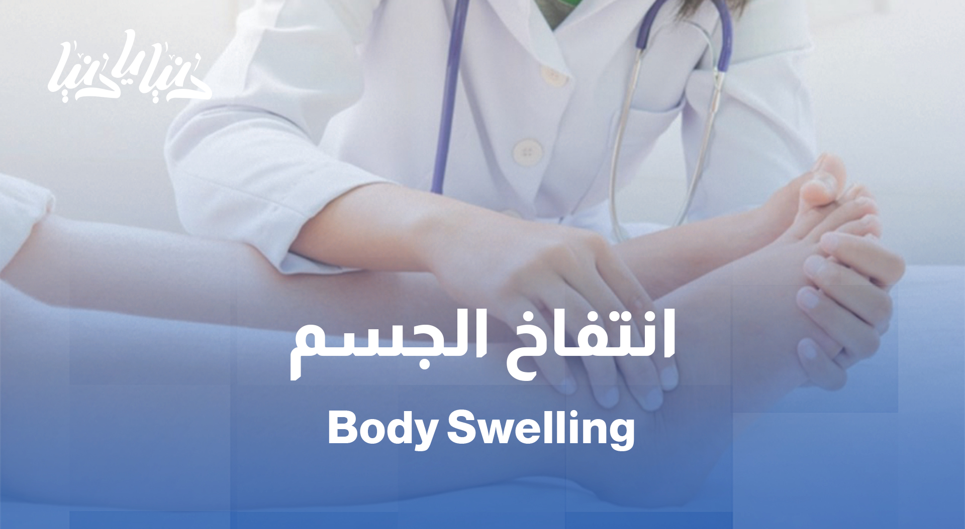 تورّم وانتفاخ؟ تعرّف على أسباب احتباس السوائل وأعد التوازن لجسمك